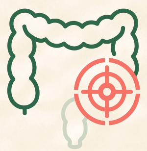 Diverticulosis
