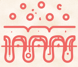 Leaky Gut Syndrome